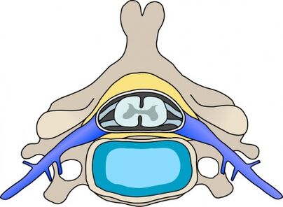 Protabian dans la vertèbre avec ostéochondrose cervicale