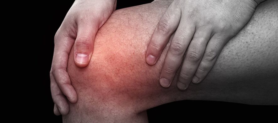 Inflammation et inconfort du genou avec gonarthrose.